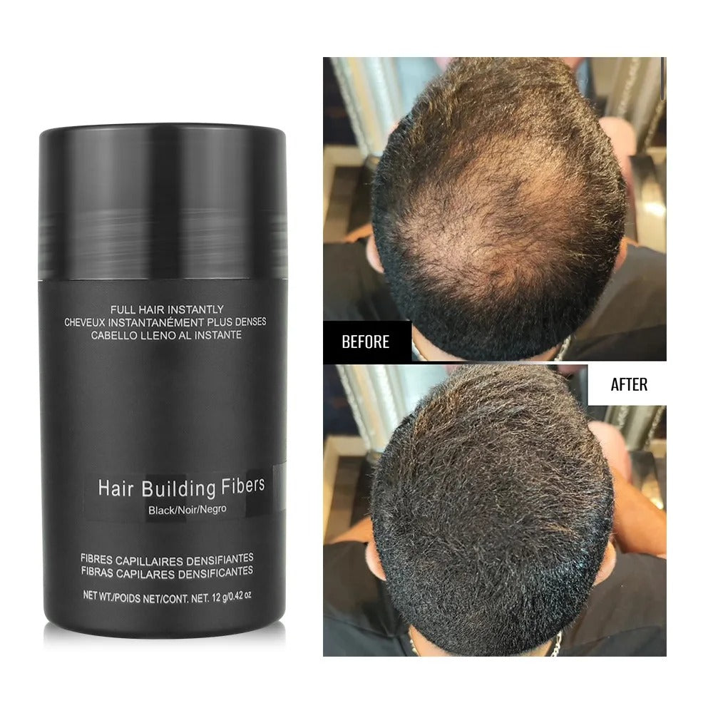 Kit Premium Toppik  Cobertura Total + aplicador y un super 🎁 regalo fijador definitivo.